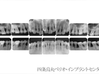 レントゲン検査