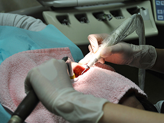 PMTC(Professional Mechanical Tooth Cleaning)